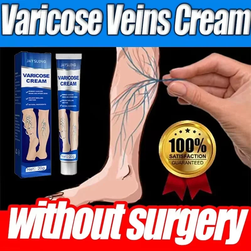 Ointment for Varicose Veins Eliminate .