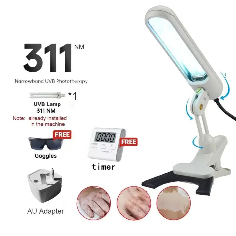 Treatment of vitiligo psoriasis with 311 NM narrow-band ultraviolet light by UVB phototherapy instrument