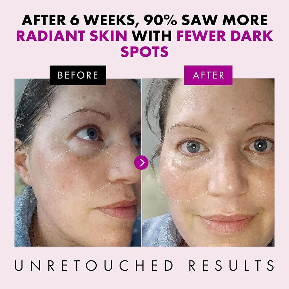 Collagen Anti Wrinkle , Korean Skin Care