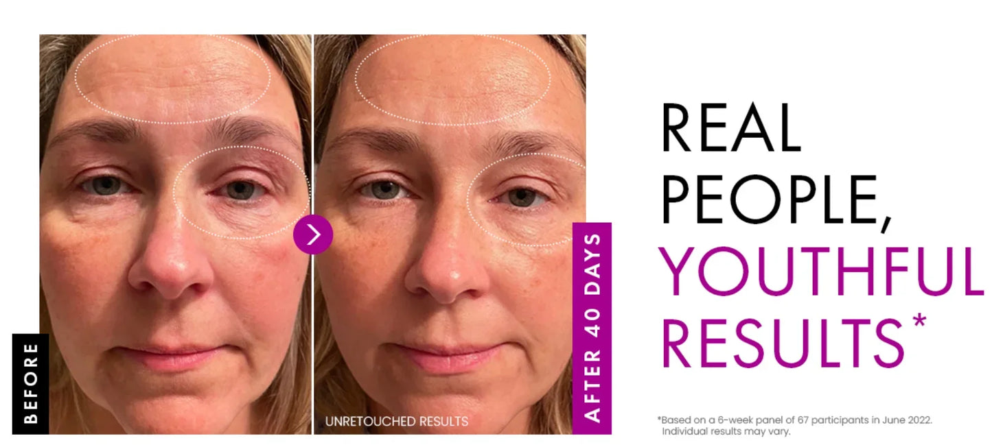 Collagen Anti Wrinkle , Korean Skin Care