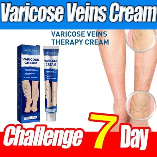 Ointment for Varicose Veins Eliminate .