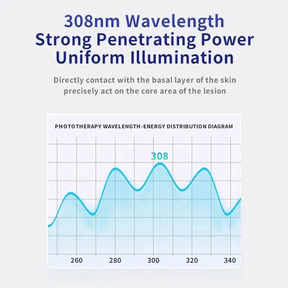 Treatment of vitiligo psoriasis with 311 NM narrow-band ultraviolet light by UVB phototherapy instrument