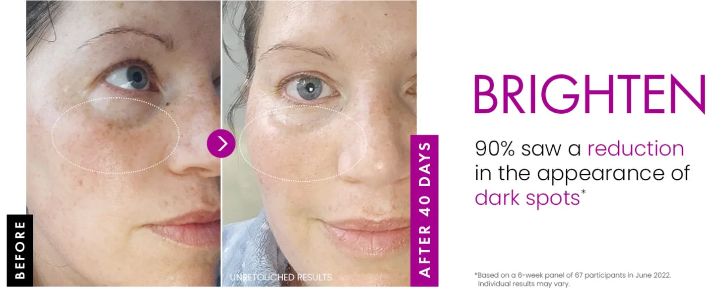 Collagen Anti Wrinkle , Korean Skin Care