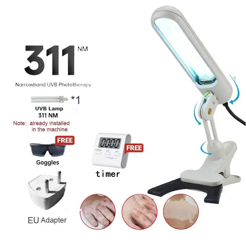 Treatment of vitiligo psoriasis with 311 NM narrow-band ultraviolet light by UVB phototherapy instrument