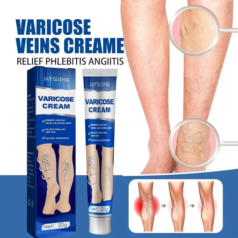 Ointment for Varicose Veins Eliminate .
