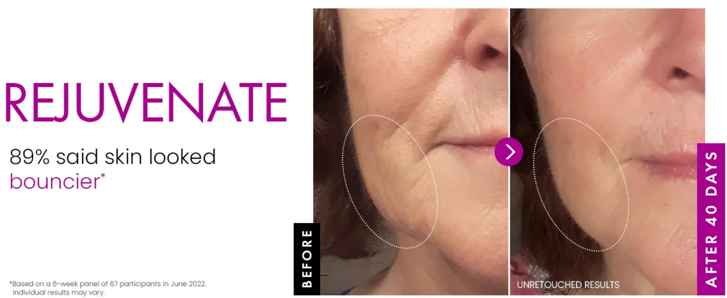 Collagen Anti Wrinkle , Korean Skin Care